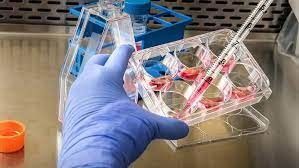 В Якутии выявили случаи оспы обезьян? По слухам и по существу