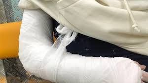 В Якутске мужчина украл у женщины 23 тысячи рублей и сломал ей руку