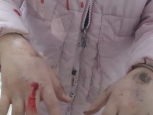 МВД: Собака покусала девочку в Нюрбинском районе Якутии