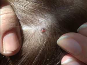 В Якутии четверо человек пострадали от укусов клещей