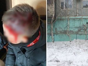 4 шва у ребенка: штраф 40.000