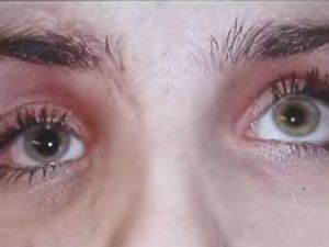 Как не потерять лицо после драки:  интервью челюстно-лицевого хирурга