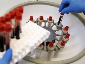 Источник рассказал о разработке в России двух лекарств от ВИЧ