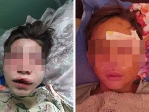В Томпонском районе избили двух подростков: приговор вступил в законную силу 