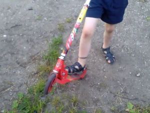 Дежурный прокурор: В Якутске ребенок получил тяжелые травмы, упав с самоката