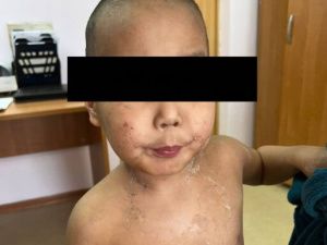 Что с ребенком, найденным голым на улице в Якутске?