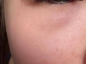 Не смогла открыть глаза: в Якутии девушка обратилась в больницу после наращивания ресниц