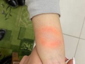 Собака укусила ребенка в контактном зоопарке Якутска