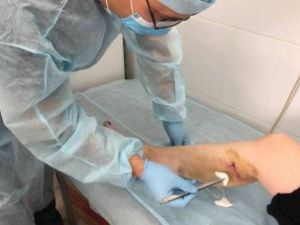 Почти пятьсот жителей Якутска пострадали от укусов собак с начала года