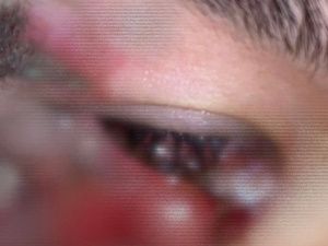 Прошелся лицом по земле: Прогулка на самокате закончилась операцией