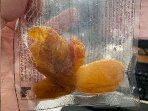 В Якутии врачи достали из кишечника 70-летней женщины три целых абрикоса