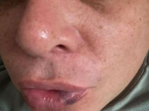 Пятеро мужчин избили своего знакомого дубинкой в подъезде дома на улице Курашова, двое из них уже задержаны