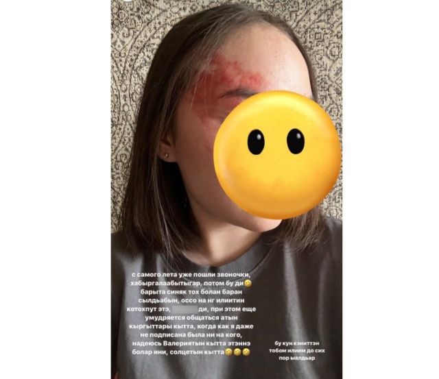 Якутянка заявила о том, что ее бил певец Семен А. В Якутии в майские выходные участились случаи домашнего насилия