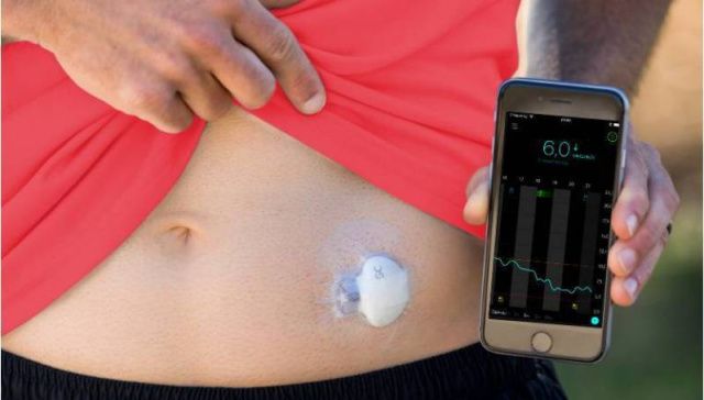 В Якутии внедряют систему непрерывного мониторинга глюкозы у пациентов с сахарным диабетом