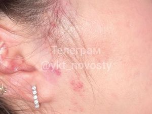 «Он бил меня до потери сознания»: якутянка рассказала о побоях в отношениях