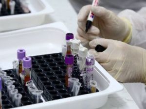 В Якутии зарегистрирован 1 новый случай коронавируса. В Якутск доставлены больные из Горного и Вилюйского улусов