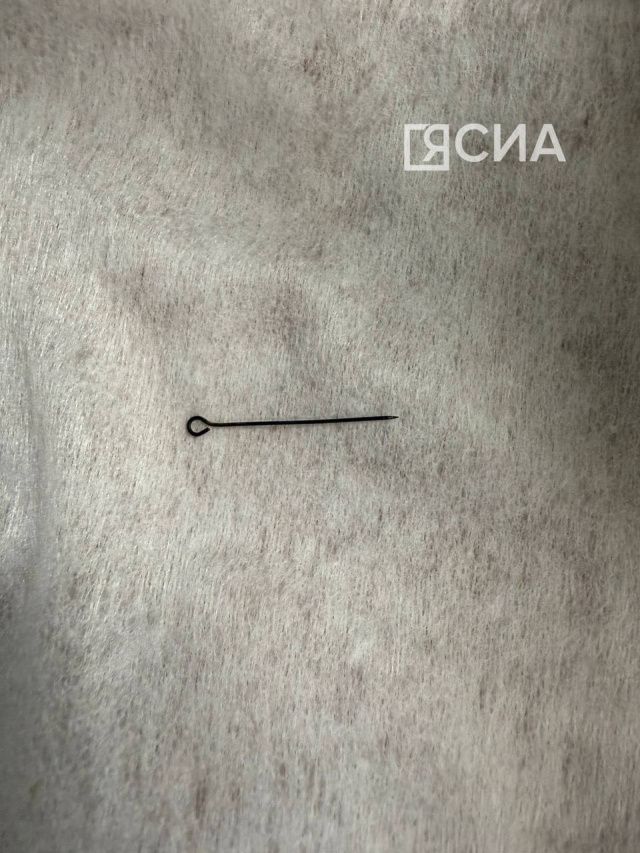 Острая боль: В Якутии женщина проглотила булавку, которая воткнулась в слизистую желудка