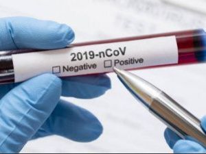 В Якутии число зараженных коронавирусом возросло до 88