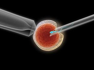 Практически в 5 раз увеличилось число проводимых в Якутии процедур ЭКО