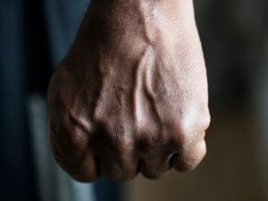 Не поделили танцпол: Один из танцоров сломал другому челюсть в ночном баре