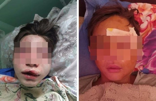 "Зачем ты это сделал с семилетней девочкой?": Появилось видео избиения подростков в Якутии