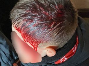 Лишь по счастливой случайности удалось избежать трагедии