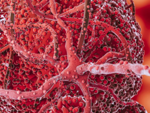 Врач рассказал о первых признаках образования тромбов