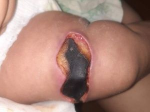 Жуткая трагедия с ребенком в Якутске