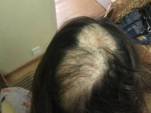 На Комсомольской площади девушка лишилась волос, катаясь в картинг-центре