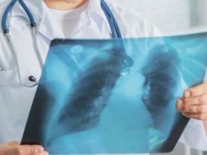 Больного туберкулезом жителя Якутии отправили на принудительное лечение