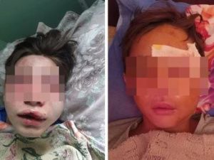 В селе в Якутии жестоко избили двух подростков: Дело направлено в суд