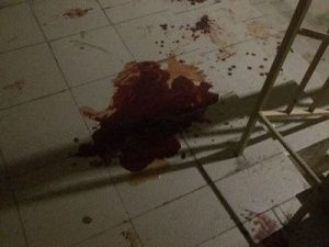 Фотофакт: В Якутске подъезд залит кровью