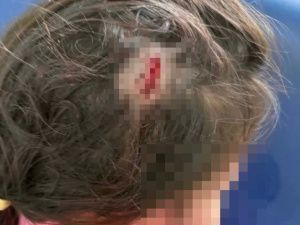 По иску прокуратуры детский сад в Олекминском районе выплатит 105 тысяч рублей за травму ребенка