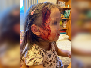 «Камеры не работают». Сестра пострадавшей от выстрела из пневматического ружья девочки рассказала, как продвигается расследование инцидента в Якутске 