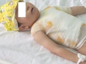 Суд взыскал с родителей школьника-пиромана, поджегшего мальчика на детской площадке, три миллиона рублей