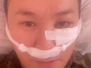 На Днях Якутии в Казани был зверски избит певец Саарын 