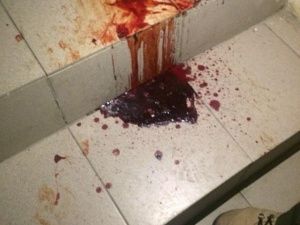 В Якутске подъезд залит кровью: Комментарий МВД