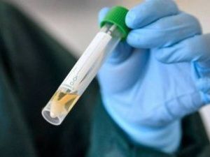 В Якутии за последние сутки выявлено 47 случаев коронавируса