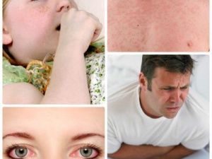 Аллергики могут задать вопросы врачу Якутской городской больницы №3