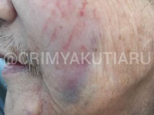 В Якутске неизвестный ворвался в квартиру пожилого человека, избил его и ограбил