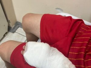 В Алдане покусанный собакой ребенок почти месяц страдает от ран, но никто еще не ответил за нападение животного