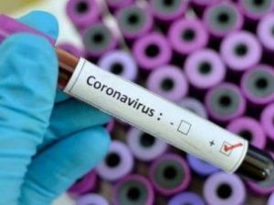 За последние сутки еще у 215 якутян диагностирован COVID-19. Зафиксировано четыре летальных случая