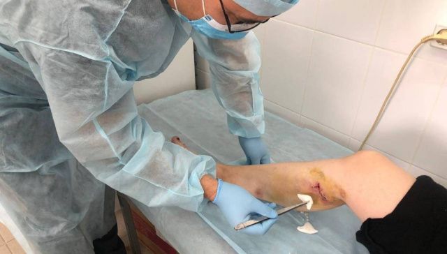 Почти пятьсот жителей Якутска пострадали от укусов собак с начала года