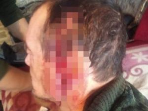 Главврач Булунской ЦРБ о состоянии жертвы белого медведя