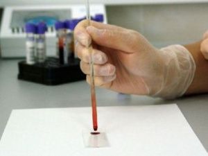 В Якутии за сутки зарегистрировано 33 новых случаев коронавируса