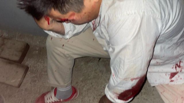 Полиция Якутска прокомментировала нападение вооруженной толпы на молодую пару 