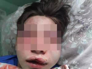 Двух подростков жестоко избили в Томпонском улусе