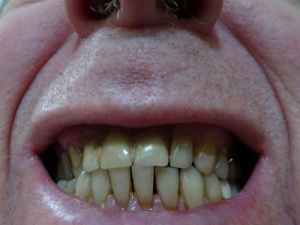 В Якутии пьяный авиапассажир покусал полицейского