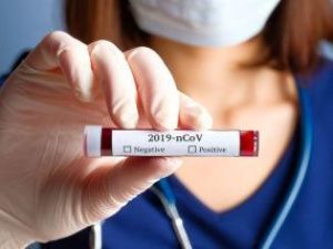 В Якутии выявлено 179 новых случаев коронавирусной инфекции