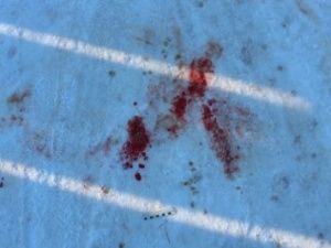 Житель Якутии до смерти избил металлическим черенком и деревянной скамьей своего знакомого